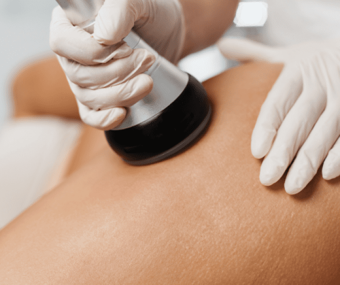 Lipocavitation 